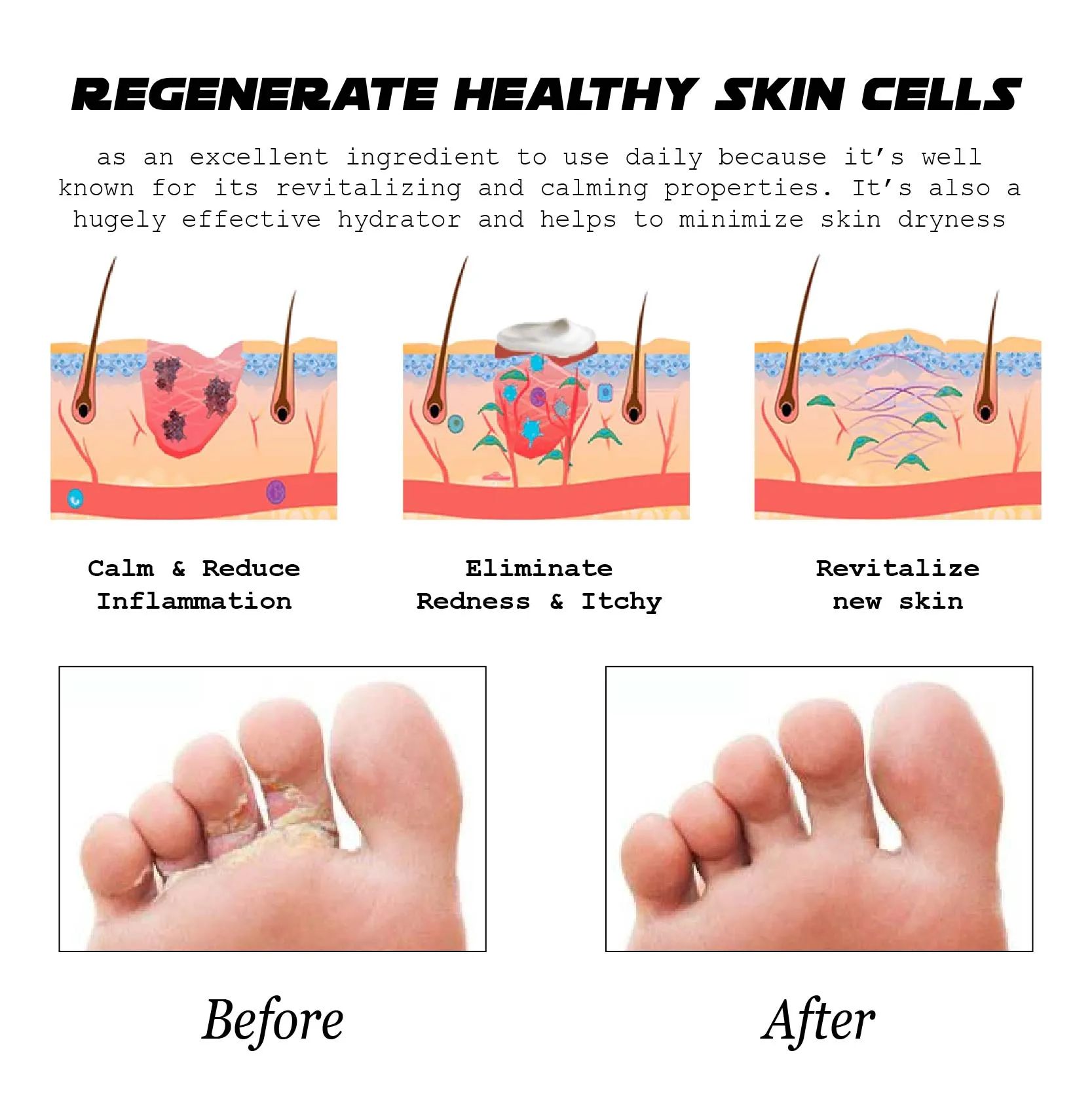 ATTDX AthletesFoot FungusRelief TreatmentSpray