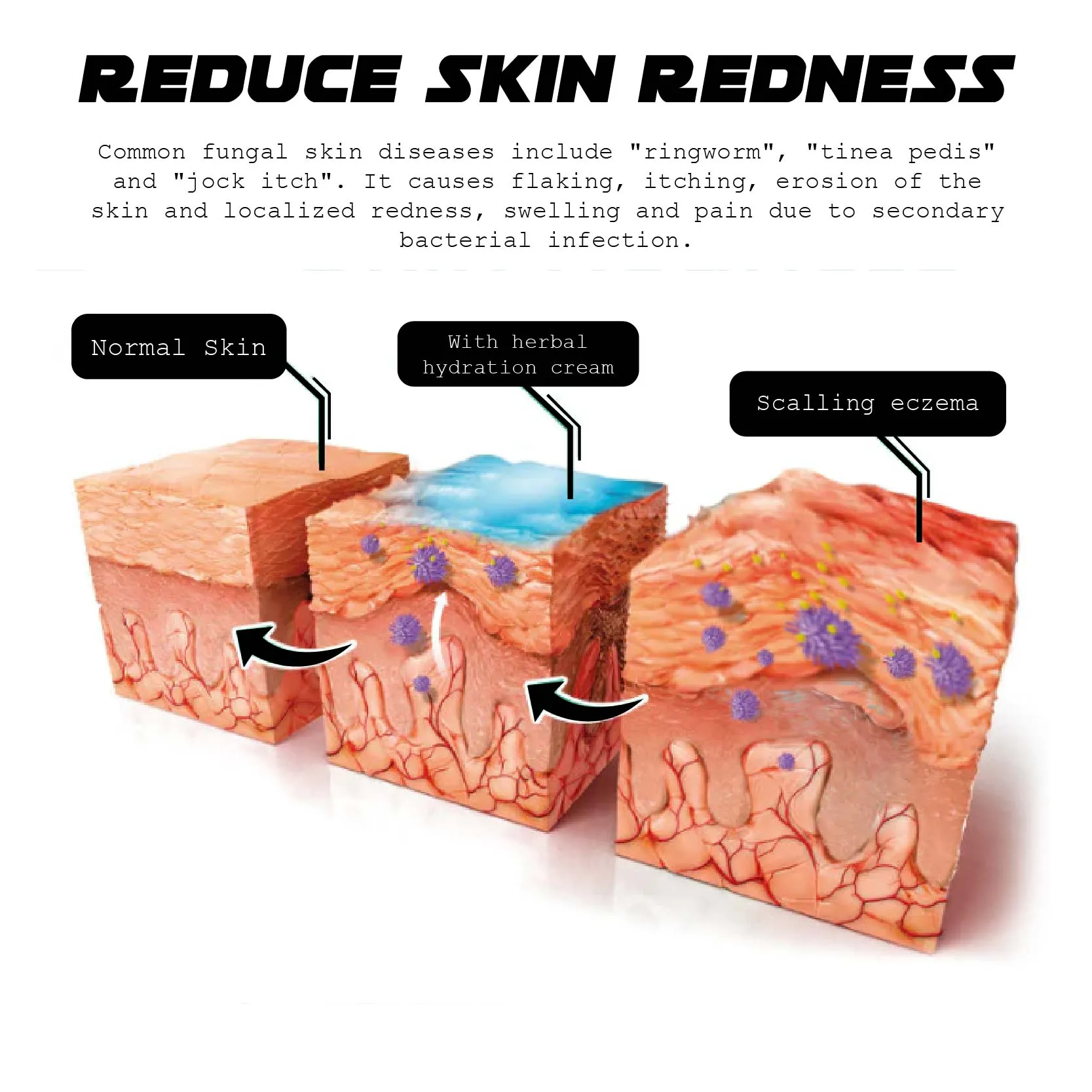 ATTDX AthletesFoot FungusRelief TreatmentSpray